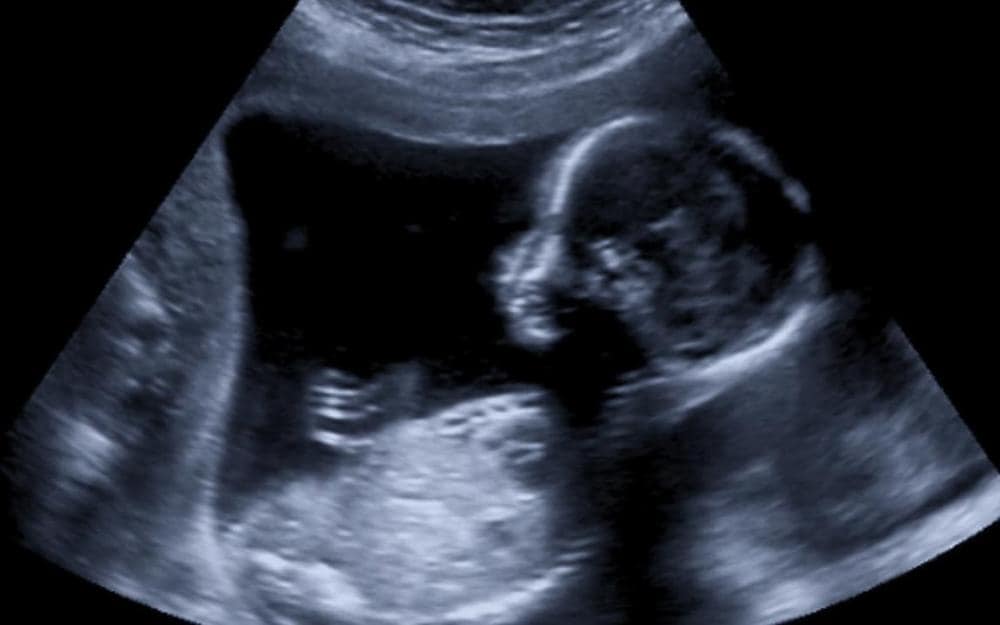 13week