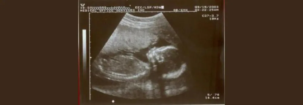 20-week