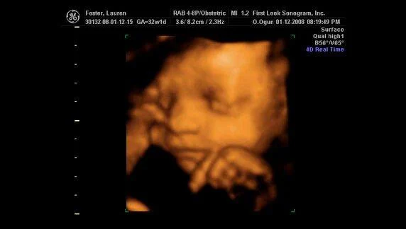 32week